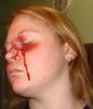 Filename=leftsidebruise.jpg
Filesize=51KiB
Dimensions=450x521
Date added=Jan 02, 2006 leftsidebruise.jpg