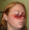 Filename=rightsidebruise.jpg
Filesize=129KiB
Dimensions=450x472
Date added=Jan 02, 2006 rightsidebruise.jpg